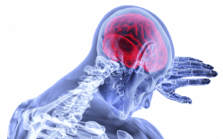 Sportiva Mens - meningite