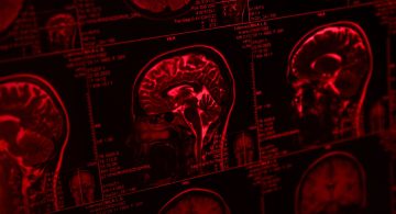 Sezioni di risonanza magnetica del cervello umano visualizzate su schermo