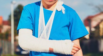 fratture nei giovani - Sportiva Mens