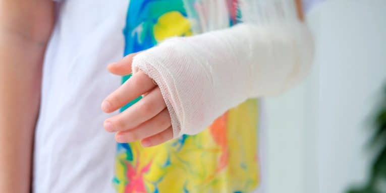 Primo piano del braccio ingessato di un bambino con fasciatura bianca.