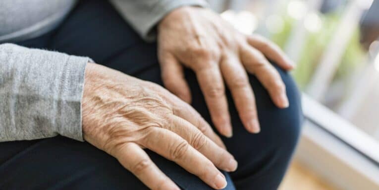 Differenza osteoartrosi e artrite reumatoide