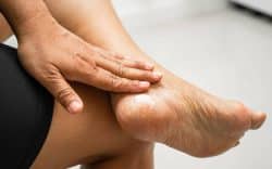 Dolore al tallone cause - SportivaMens