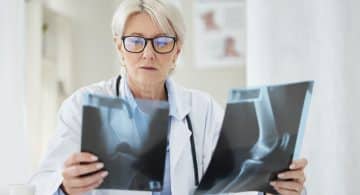 Osteofitosi - SportivaMens